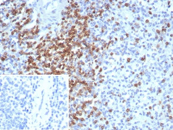 IHC staining of FFPE human spleen tissue with CD2 antibody (clone LFA2/8681R). Inset: PBS used in pl