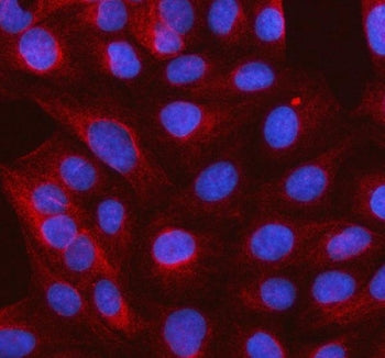 Immunofluorescent staining of FFPE human U-2 OS cells with SLC37A3 antibody (red) and DAPI nuclear s