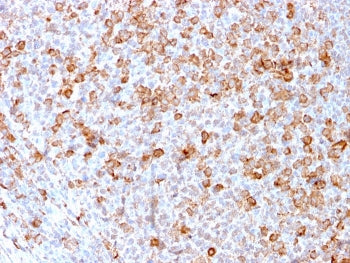 IHC staining of FFPE human tonsil with CD3e antibody (clone C3e/3171R). HIER: boil tissue sections i