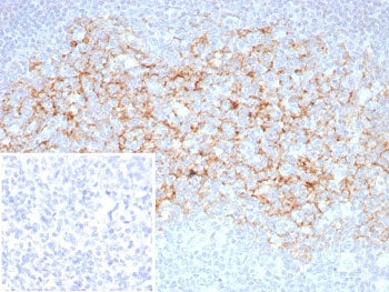 CD23 Antibody
