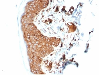 Recombinant B2M Antibody / Beta-2 Microglobulin