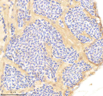 IHC staining of FFPE zebrafish heart tissue with Ppp3r1 antibody, HRP-labeled secondary and DAB subs