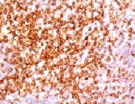IHC analysis of human tonsil and CD6 antibody (clone CLDA6-1). Staining of formalin-fixed tissues re