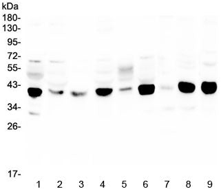 Western blot testing of human 1) HeLa, 2) MDA-MB-231, 3) HL-60, 4) MDA-MB-453, 5) A431, 6) Caco-2, 7