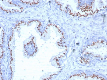 IHC staining of FFPE human prostate tissue with Solute carrier family 45 member 3 antibody (clone SL