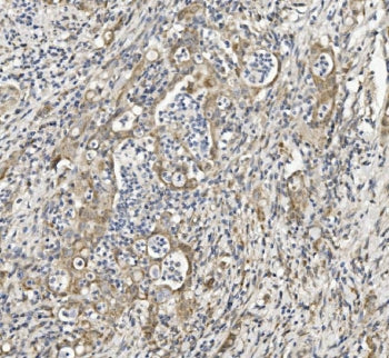 Semaphorin 6A Antibody / SEMA6A