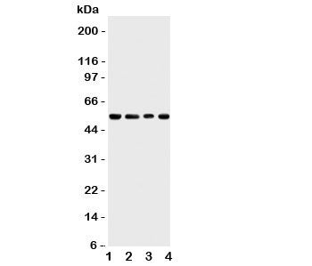 Western blot testing of TRAF4 antbody; Lane 1: rat thymus; 2: human HeLa; 3: (h) Jurkat; 4: mouse HE