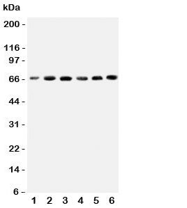 Western blot testing of CETP antbody on human cell lysates 1: HeLa; 2: COLO320; 3: HT1080; 4: Jurkat