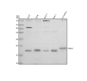 Western blot analysis of NME3 using anti-NME3 antibody. Electrophoresis was performed on a 12% SDS-P