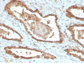 IHC staining of FFPE human prostate tissue with MIF antibody (clone MIF/6277). HIER: boil tissue sec