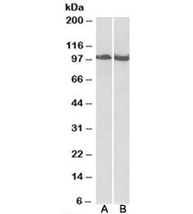 Western blot testing of mouse [A] and rat [B] skeletal muscle lysate with CLOCK antibody at 0.03ug/m