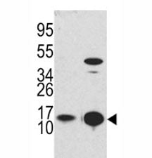 LC3B Antibody / MAP1LC3B, 0.4ml