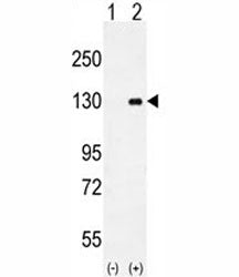 Western blot analysis of CSF1R antibody and 293 cell lysate (2 ug/lane) either nontransfected (Lane 