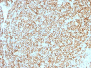 IHC testing of recombinant CD45 antibody cocktail and FFPE human tonsil (clones PTPRC/1975R + PTPRC/