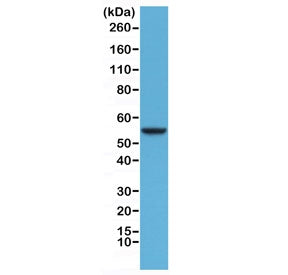 Western blot testing of human HeLa cell lysate with recombinant CK8 antibody at 1:1000. Predicted mo