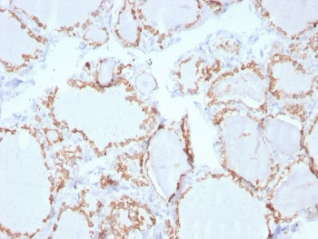 Thyroid Peroxidase Antibody