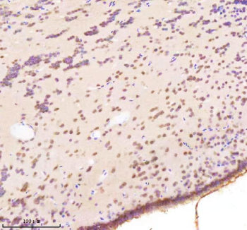Immunohistochemical analysis of Bap1 protein using Zebrafish Bap1 antibody and paraffin-embedded zeb