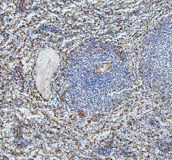IHC staining of FFPE human spleen tissue with P-Selectin antibody, HRP-labeled secondary and DAB sub