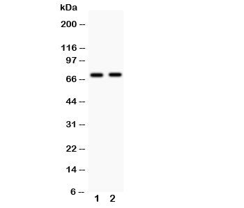 Western blot testing with MEKK3 antibody Lane 1: rat brain; 2: mouse brain. Expected size ~71KD