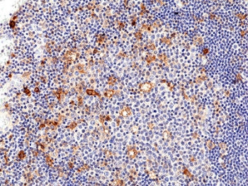 IL2RA Antibody / CD25