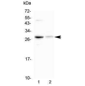 Western blot testing of 1) mouse HEPA1-6 and 2) rat kidney lysate with Oncostatin M antibody at 0.5u