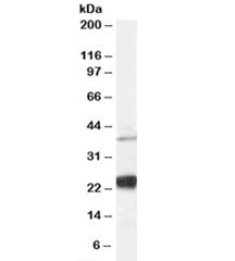Western blot testing of human HeLa cell lysate and NIP antibody at 0.03ug/ml. Predicted molecular we