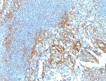 IHC staining of FFPE human tonsil tissue with ICAM-1 antibody (clone ICAM1/6917). HIER: boil tissue 