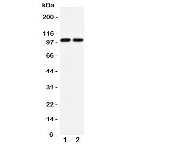 Western blot testing of GLUR3 antibody and Lane 1: rat brain; 2: mouse brain lysate. Predicted/obser
