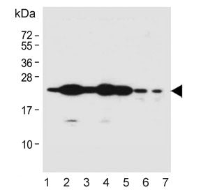 Western blot testing of human 1) HEK293, 2) A549, 3) Hela, 4) T-47D, 5) U-87 MG, 6) mouse liver and 