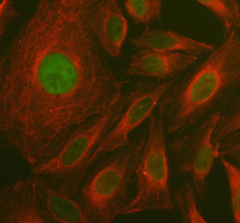 Western blot testing of 1) rat liver and 2) mouse liver tissue lysate with Mat1a antibody. Predicted