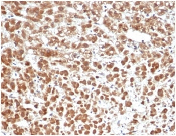 IL1 beta Antibody / IL1B