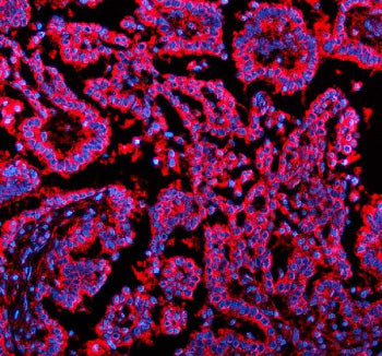 Immunofluorescent staining of NSDHL using anti-NSDHL antibody (red). NSDHL was detected in a paraffi