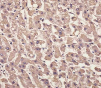 IHC testing of FFPE human liver tissue with Transthyretin antibody. HIER: steam section in pH6 citra