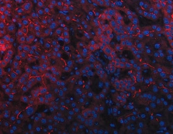 DEP1 Antibody / Density-enhanced phosphatase 1 / PTPRJ
