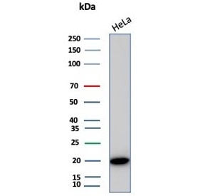 Western blot testing of human HeLa cell lysate with Crystallin Alpha B antibody (clone CRYAB/4666). 