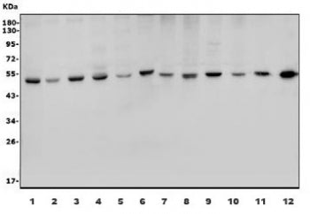 Western blot testing of human 1) HeLa, 2) U-87 MG, 3) MDA-MB-453, 4) MCF7, 5) Jurkat, 6) ThP-1 and r