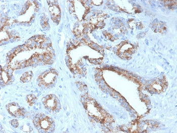 AMACR / p504S Antibody (Prostate Cancer Marker)