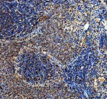 IHC staining of FFPE rat spleen with Interleukin 10 antibody. HIER: boil tissue sections in pH8 EDTA
