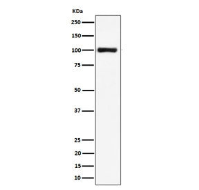 Western blot testing of human HeLa cell lysate with NCL antibody. Predicted molecular weight ~77 kDa