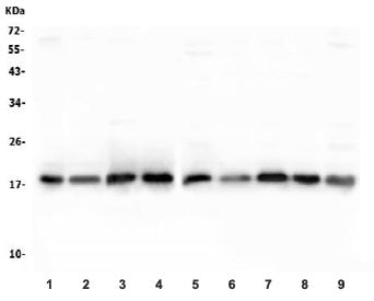 Superoxide Dismutase 1 Antibody (SOD1)