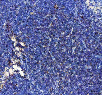 IP10 Antibody / CXCL10