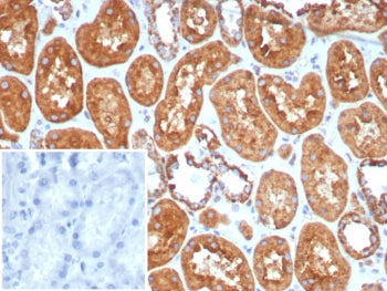 IHC staining of FFPE human kidney tissue with HSP60 antibody (clone HSPD1/8406R). Inset: PBS used in
