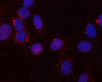 Immunofluorescent staining of FFPE human U-2 OS cells with SNX6 antibody (red) and DAPI nuclear stai