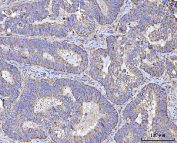 REN Antibody / Renin