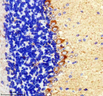 Immunohistochemical staining of TIGAR using anti-TIGAR antibody. TIGAR was detected in a paraffin-em