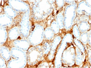 FABP1 Antibody
