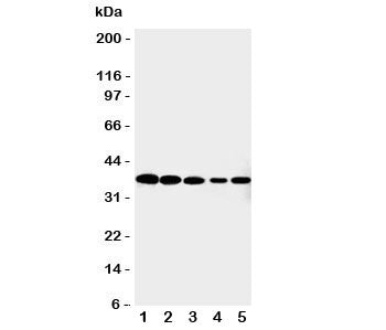 Western blot testing of Cdk7 antibody and Lane 1: HeLa; 2: MCF-7; 3: A549; 4: COLO320; 5: Jurkat cel