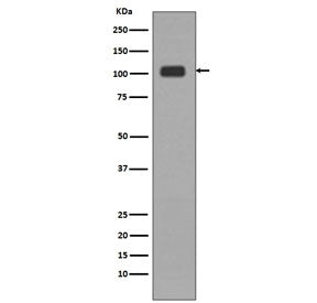 Western blot testing of human HeLa lysate with KDM1 / LSD1 antibody. Predicted molecular weight ~110