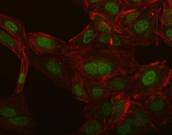 Immunofluorescent staining of FFPE human U-2 OS cells with NCX1 antibody (green) and Phalloidin (red