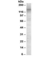 Western blot testing of Daudi cell lysate with AS160 antibody at 0.1ug/ml. Predicted molecular weigh